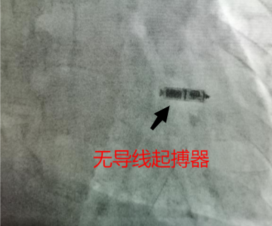 科普心脏4.png