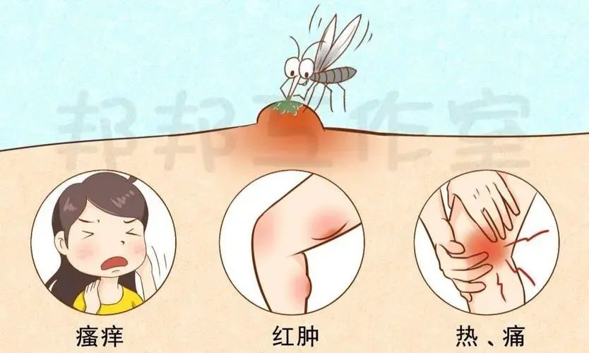 荨麻疹2.jpg